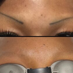 black ink removal(2)