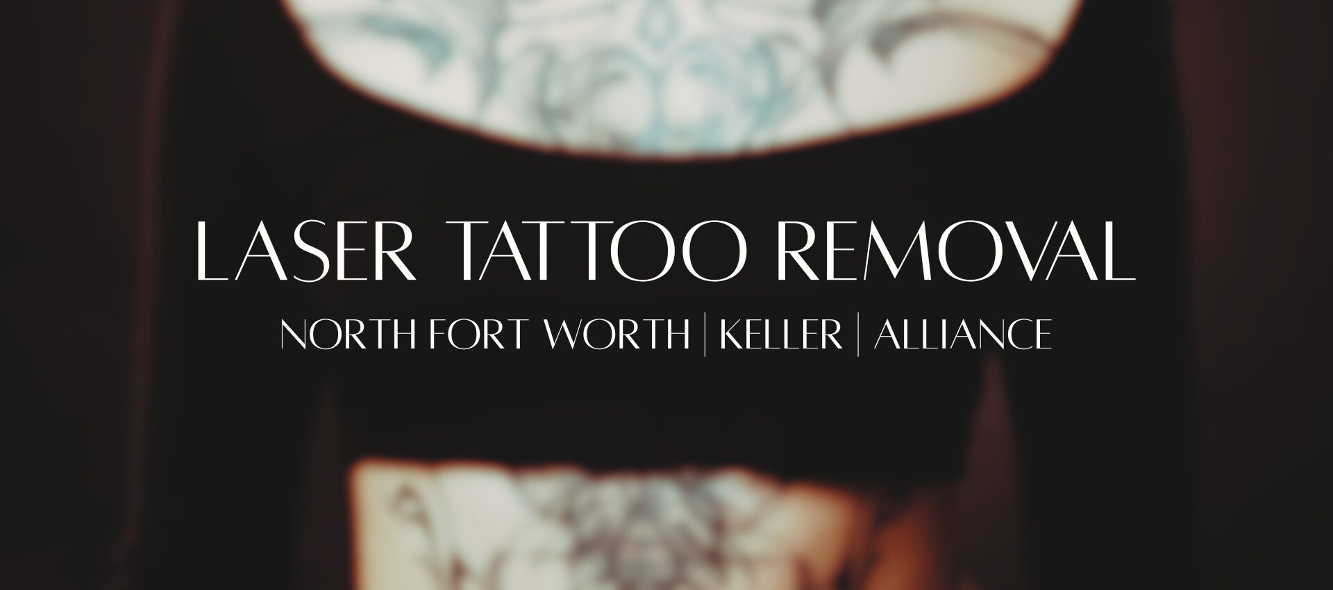laser tattoo removal north fort worth keller alliance laser tattoo removal North fort worth keller alliance